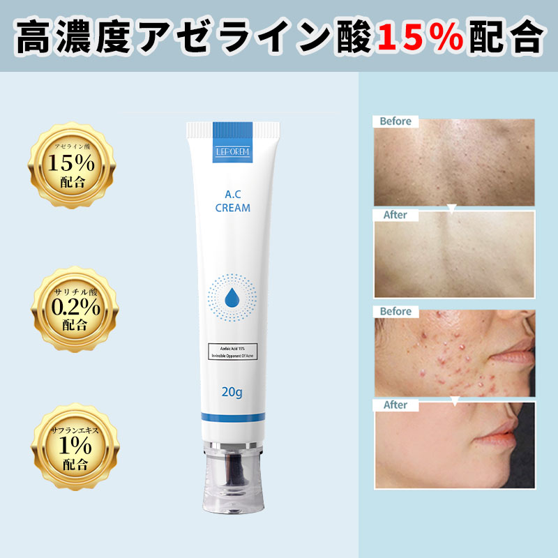 FEG for SKIN アゼライン酸15％高濃度ニキビクリーム 20g - フェイス